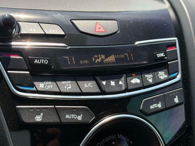 2021 Acura RDX Technology Package